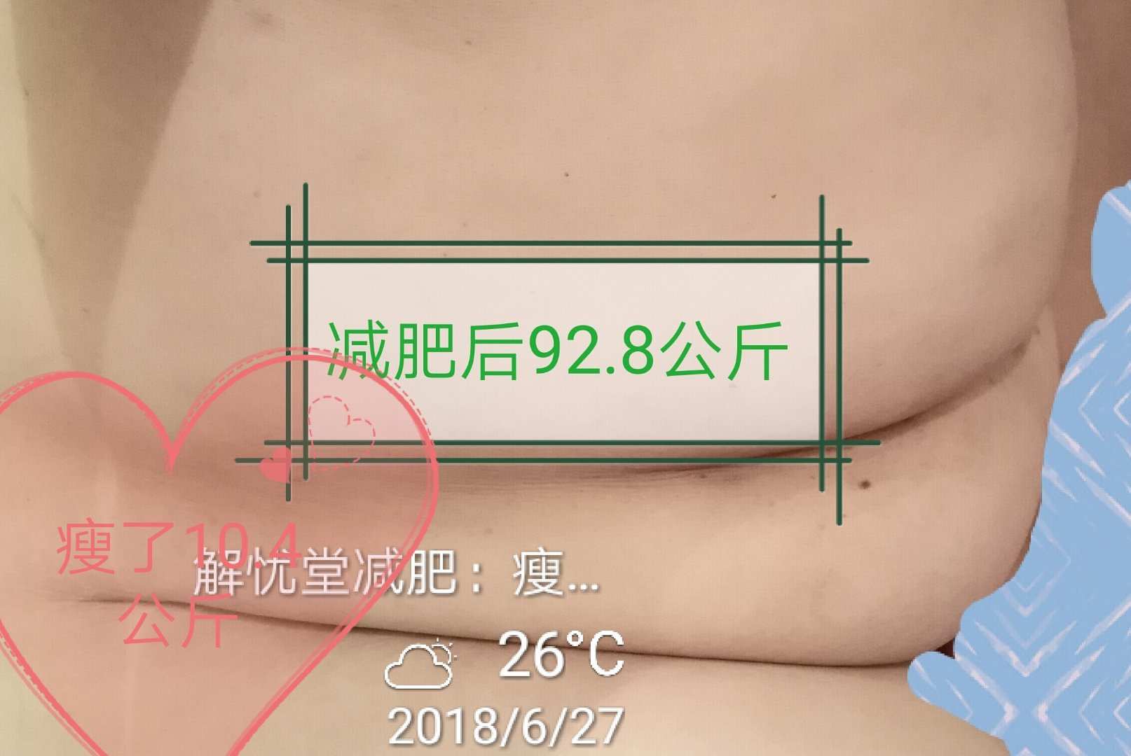 图片_20250405152718减肥后肚子状态